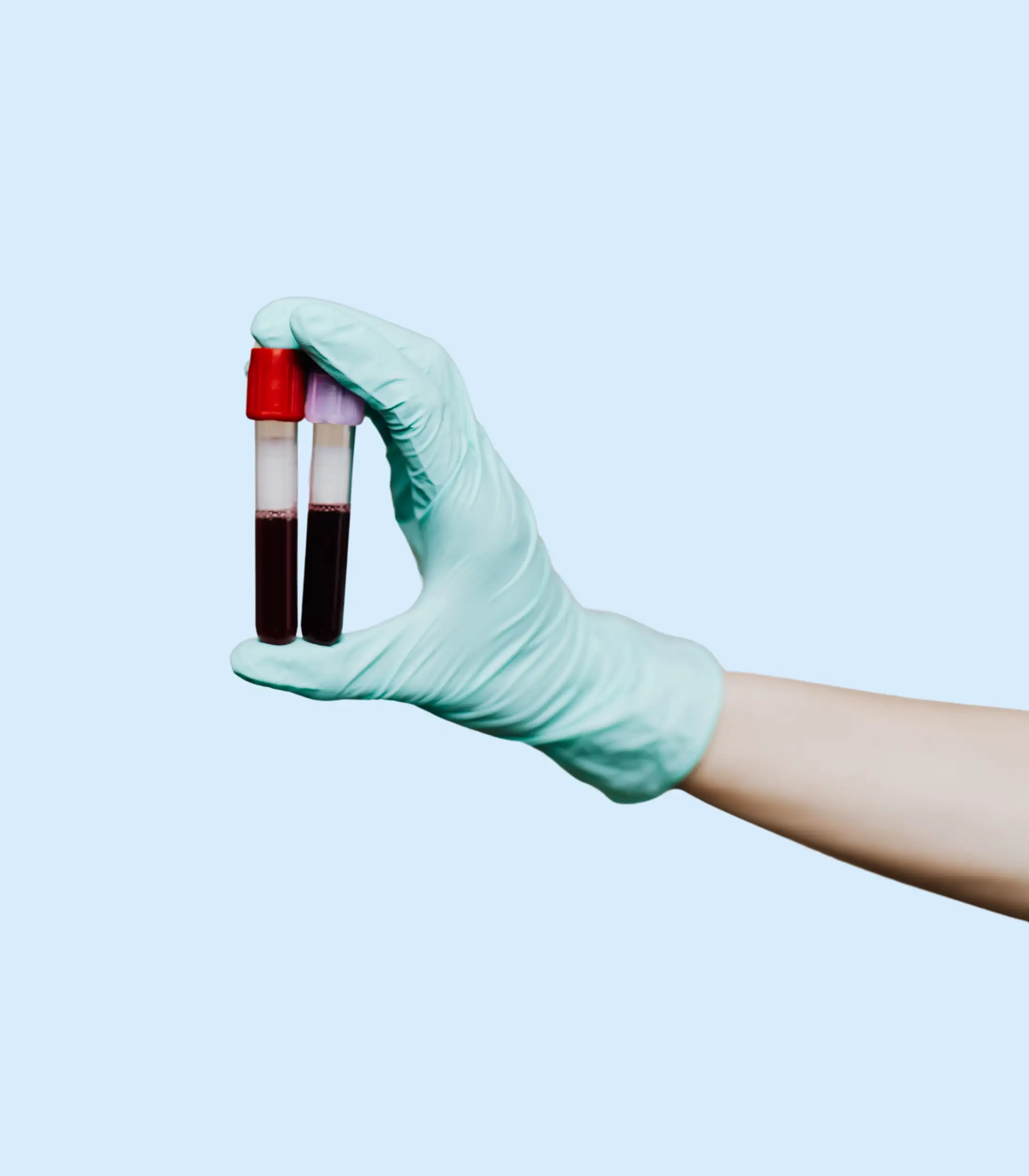 At-Home Blood Test